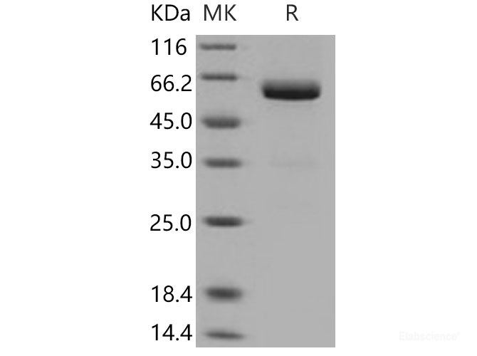 Recombinant Mouse VSIG4 Protein (His & Fc tag)-Elabscience