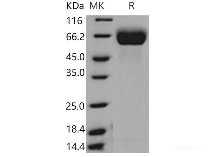 Recombinant Mouse FGFR1 / CD331 Protein (His tag)-Elabscience