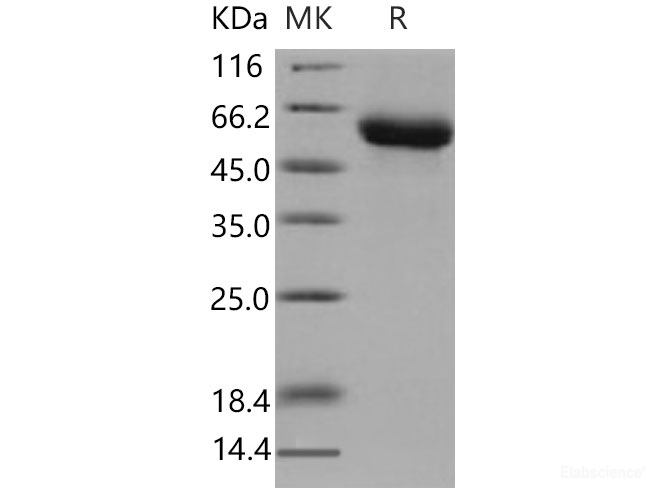 Recombinant Mouse GFRA1 / GFR alpha-1 Protein (His tag)-Elabscience