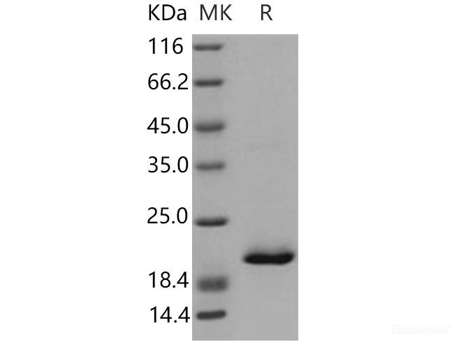 Recombinant Mouse RBP4 Protein (His tag)-Elabscience