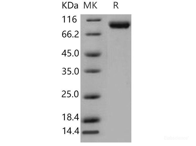 Recombinant Mouse VCAM1 / L1CAM / CD106 Protein (His tag)-Elabscience