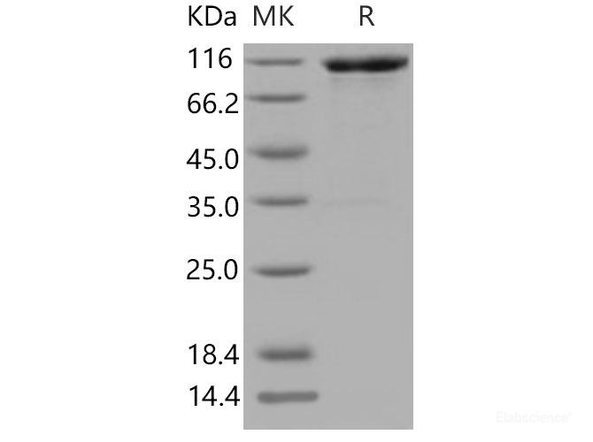 Recombinant Mouse VCAM1 / CD106 Protein (His & Fc tag)-Elabscience