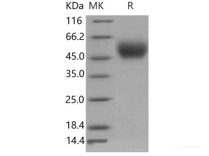 Recombinant Mouse PLAUR / CD87 / uPAR Protein (His tag)-Elabscience