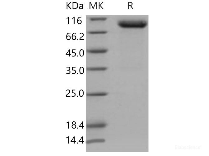 Recombinant Mouse PLAUR / CD87 / uPAR Protein (His & Fc tag)-Elabscience