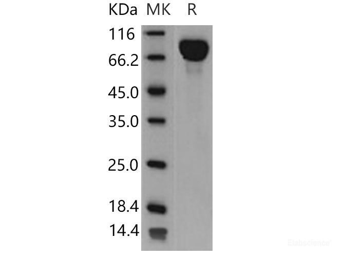 Recombinant Mouse IL6ST / gp130 / CD130 Protein (His tag)-Elabscience