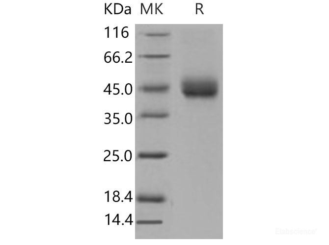 Recombinant Mouse TFPI / LACI / EPI Protein (His tag)-Elabscience