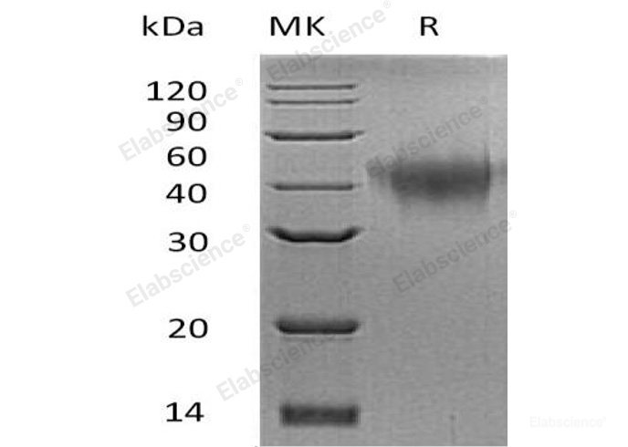 Recombinant Mouse  TNFR2 Protein (His Tag)-Elabscience