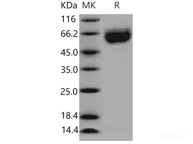 Recombinant Mouse Axl Kinase Protein (His tag)-Elabscience