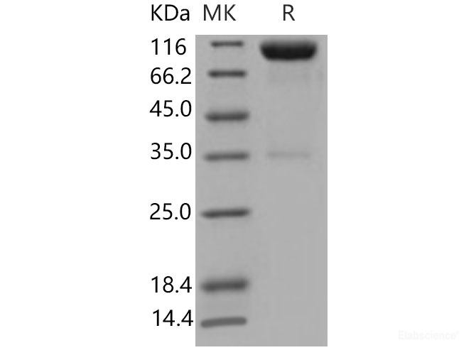 Recombinant Mouse Axl Kinase Protein (His & Fc tag)-Elabscience