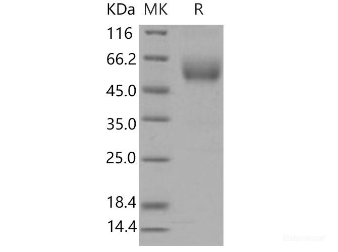 Recombinant Mouse SIGIRR / TIR8 Protein (His & Fc tag)-Elabscience