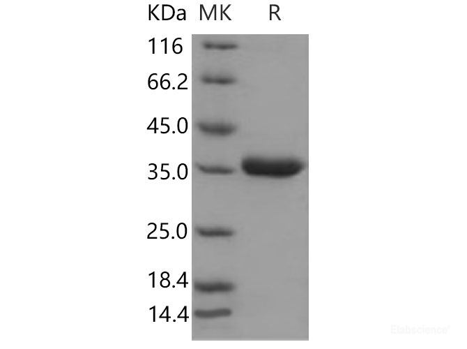 Recombinant Mouse Prostasin / PRSS8 Protein (aa 30-289, His tag)-Elabscience