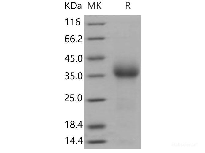 Recombinant Mouse  CD27 Protein (His Tag)-Elabscience