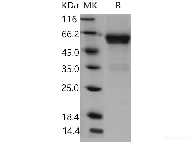 Recombinant Mouse CD27 / TNFRSF7 Protein (His & Fc tag)-Elabscience