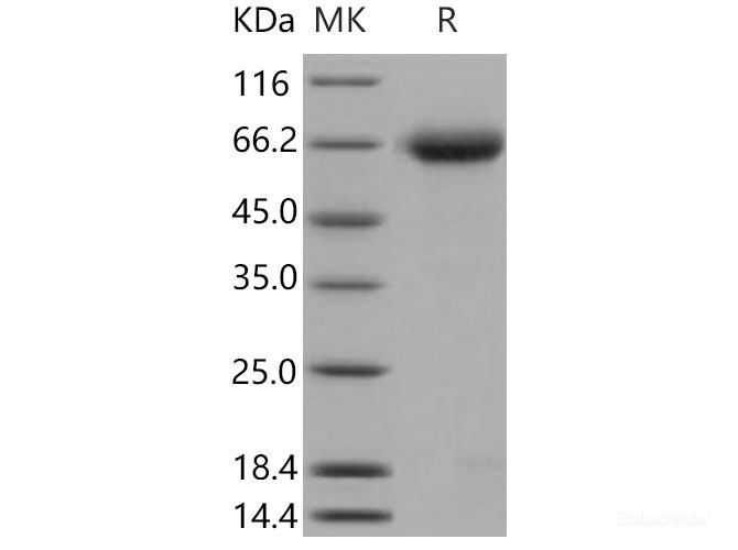Recombinant Mouse Nogo Receptor / NOGOR / RTN4R Protein (His tag)-Elabscience
