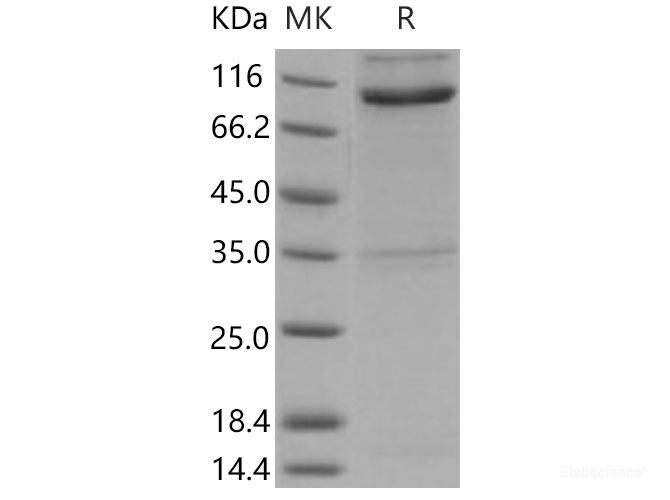 Recombinant Mouse Nogo Receptor / NOGOR / RTN4R Protein (His & Fc tag)-Elabscience