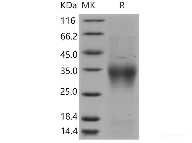 Recombinant Mouse  CD28 Protein (His Tag)-Elabscience
