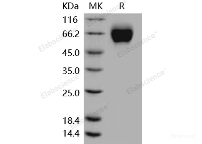 Recombinant Mouse IL18R1 / CD218a Protein (His tag)-Elabscience