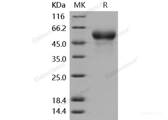 Recombinant Mouse Fetuin-A / AHSG Protein (His tag)-Elabscience