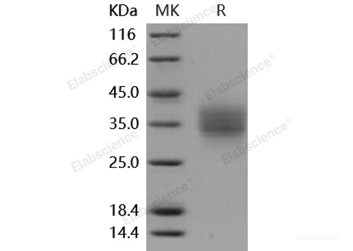 Recombinant Mouse Frizzled-1 / FZD1 Protein (His tag)-Elabscience