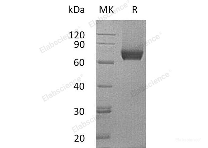 Recombinant Mouse  IL7R alpha Protein (His Tag)-Elabscience