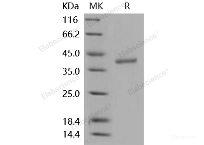 Recombinant Mouse CTSZ / CTSX / Cathepsin Z Protein (His tag)-Elabscience