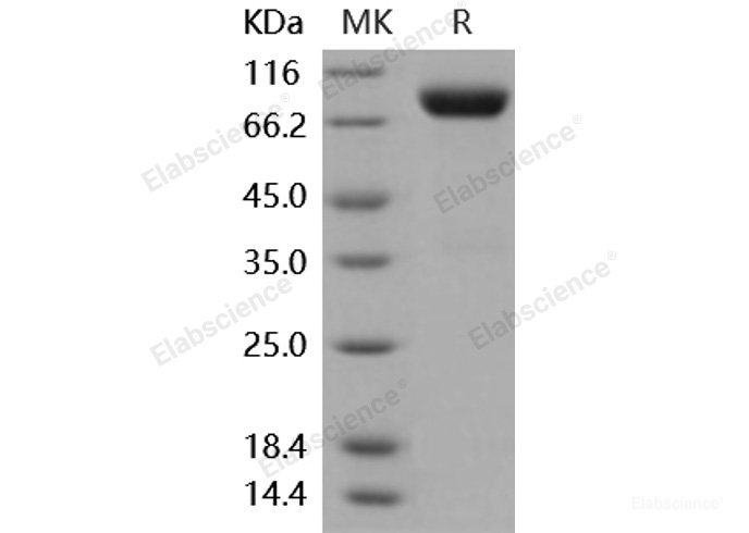 Recombinant Mouse IL2RG Protein (His & Fc tag)-Elabscience