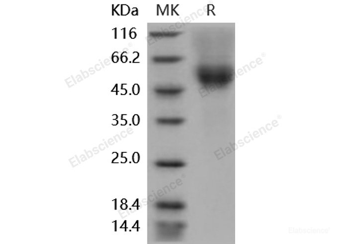 Recombinant Mouse CD64 / FCGR1 Protein (His & AVI tag), Biotinylated-Elabscience