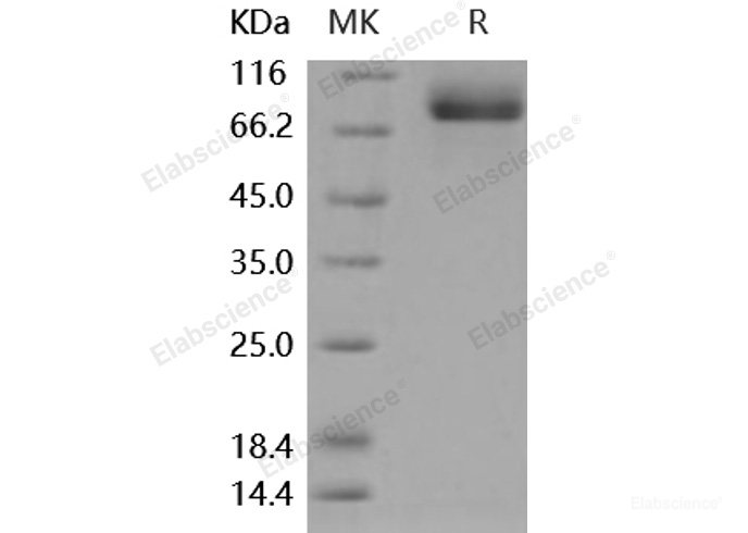 Recombinant Mouse MEP1A Protein (His tag)-Elabscience