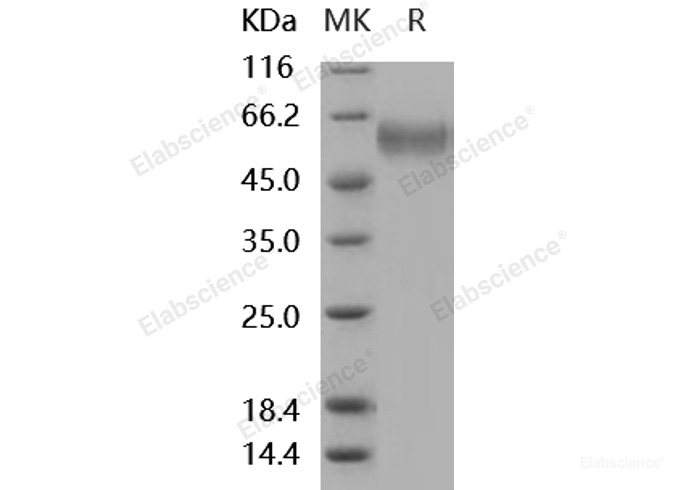 Recombinant Mouse sFRP4 Protein (His tag)-Elabscience