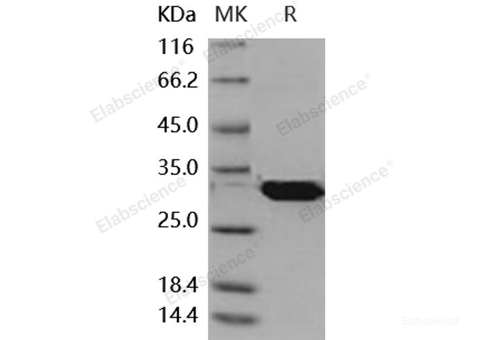 Recombinant Mouse LXN / Latexin Protein (His tag)-Elabscience