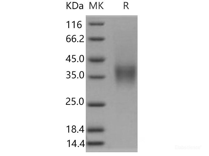 Recombinant Mouse  FCGR4 Protein (His &AVI Tag), Biotinylated-Elabscience