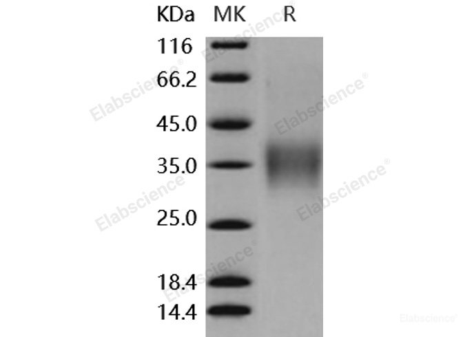 Recombinant Mouse CD16-2 / FCGR4 Protein (His & AVI tag)-Elabscience