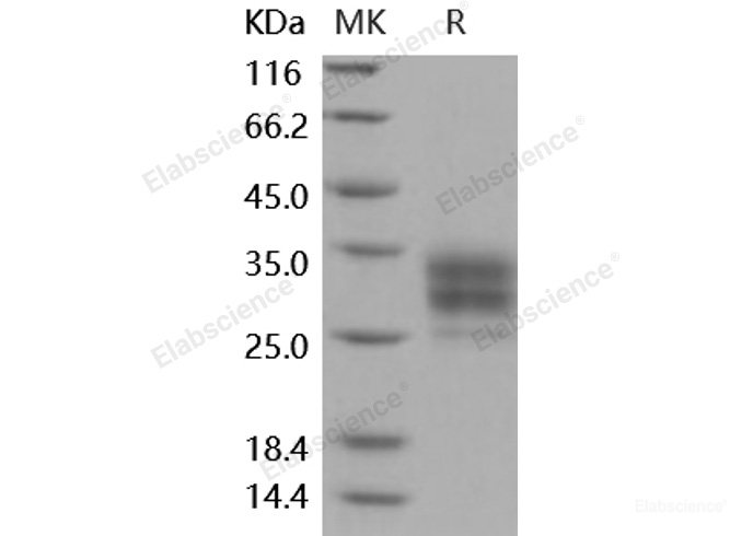 Recombinant Mouse CD16-2 / FCGR4 Protein (His tag)-Elabscience