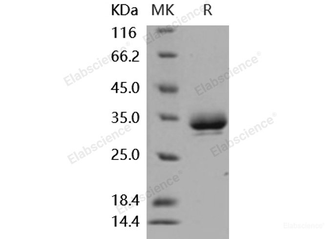 Recombinant Mouse EPOR Protein (His tag)-Elabscience