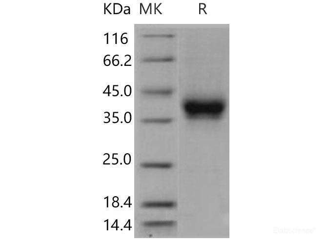 Recombinant Mouse CD32 / FCGR2B Protein (His & AVI tag), Biotinylated-Elabscience