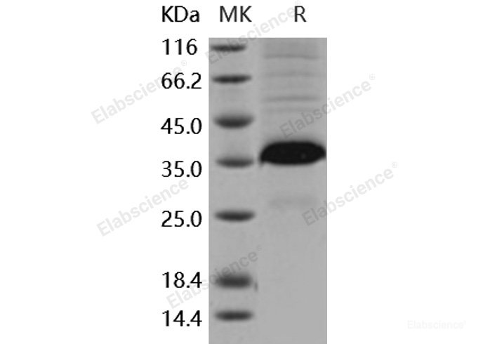Recombinant Mouse FLRG / Fstl3 Protein (His tag)-Elabscience