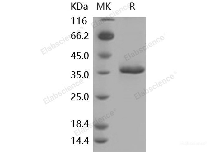 Recombinant Mouse sFRP2 Protein (His tag)-Elabscience