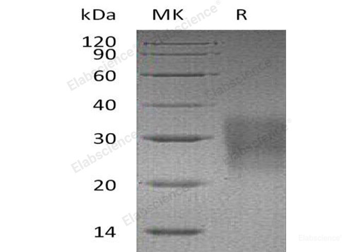 Recombinant Mouse  Fas Protein (His Tag)-Elabscience