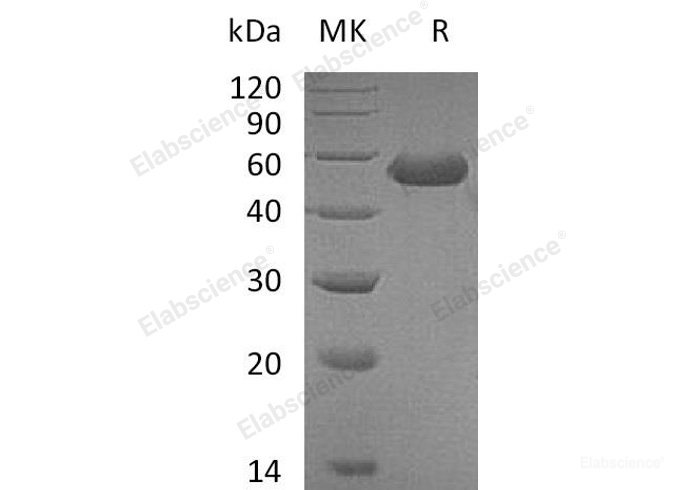 Recombinant Mouse  CD5L Protein (His Tag)-Elabscience
