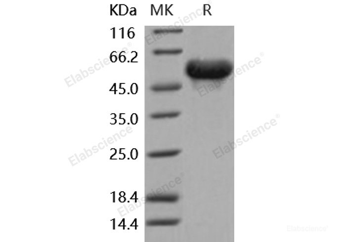 Recombinant Mouse Arylsulfatase A / ARSA Protein (His tag)-Elabscience
