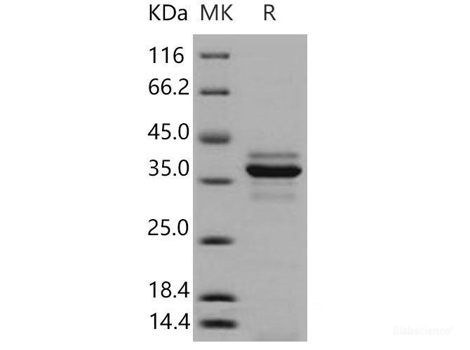 Recombinant Mouse  Cathepsin L Protein (His Tag)-Elabscience