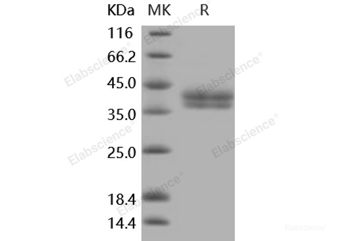 Recombinant Mouse Carbonic Anhydrase XII / Car12 Protein (His tag)-Elabscience