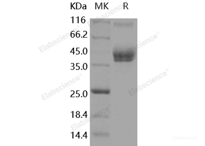 Recombinant Mouse ALCAM / CD166 Protein (His & Fc tag)-Elabscience