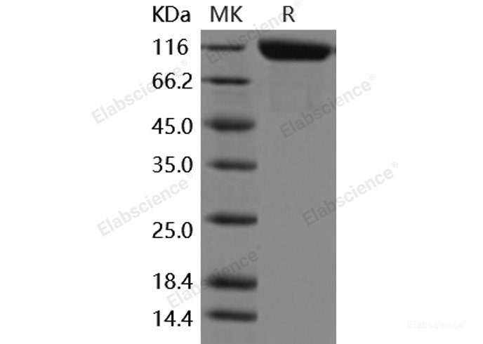 Recombinant Mouse ANPEP / APN / CD13 Protein (His tag)-Elabscience