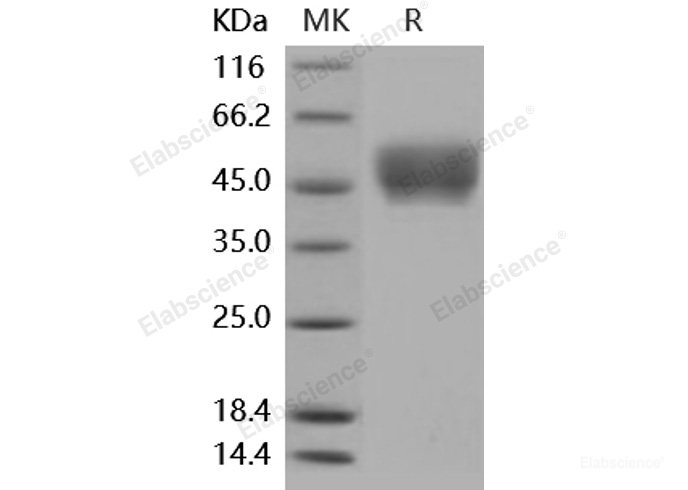 Recombinant Mouse CD64 / FCGR1 Protein (His tag)-Elabscience