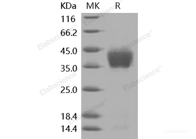 Recombinant Mouse ASGPR1 / ASGR1 Protein (His tag)-Elabscience