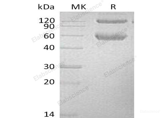 Recombinant Mouse  BMPR1A Protein (His Tag)-Elabscience