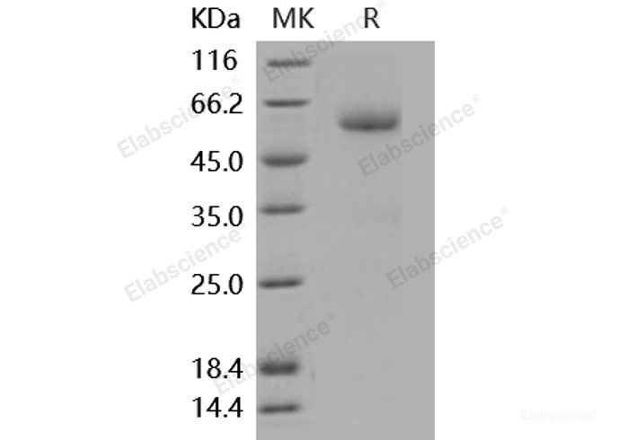 Recombinant Mouse ALK-3 / BMPR1A Protein (His & Fc tag)-Elabscience