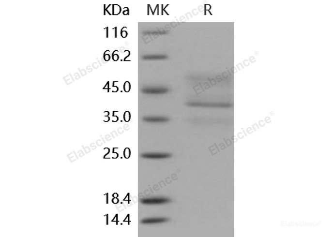 Recombinant Mouse TNFRSF17 / BCMA Protein (His & Fc tag)-Elabscience