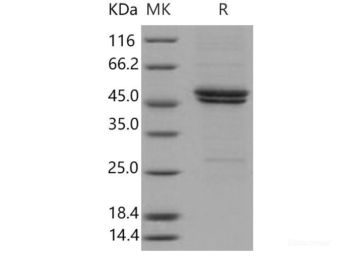 Recombinant Mouse IL11RA / IL11Rα Protein (His tag)-Elabscience